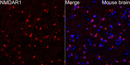NMDAR1 Rabbit Monoclonal Antibody - Image 3