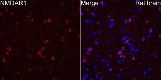 NMDAR1 Rabbit Monoclonal Antibody - Image 4