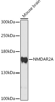 NMDAR2A Rabbit Polyclonal Antibody