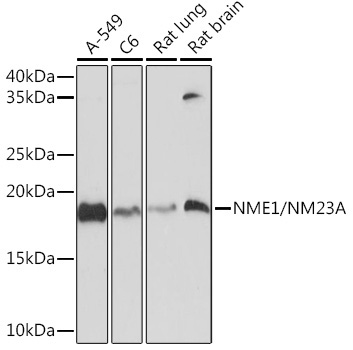 NME1/NM23A Rabbit Monoclonal Antibody
