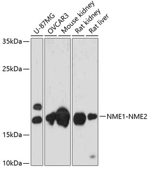 NME1-NME2 Rabbit Polyclonal Antibody