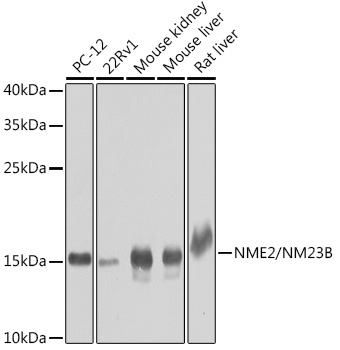 NME2/NM23B Rabbit Polyclonal Antibody