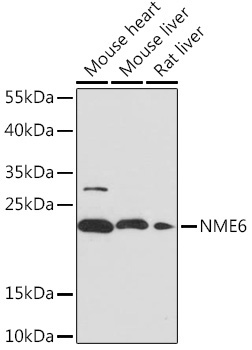NME6 Rabbit Polyclonal Antibody