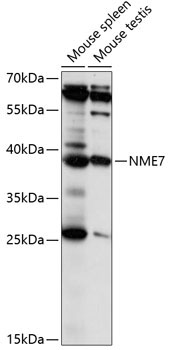 NME7 Rabbit Polyclonal Antibody