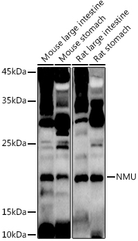 NMU Rabbit Polyclonal Antibody