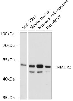 NMUR2 Rabbit Polyclonal Antibody