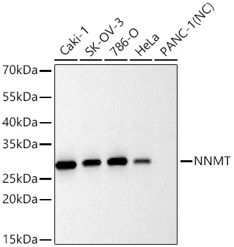 NNMT Rabbit Monoclonal Antibody