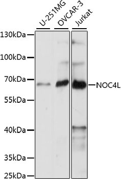 NOC4L Rabbit Polyclonal Antibody