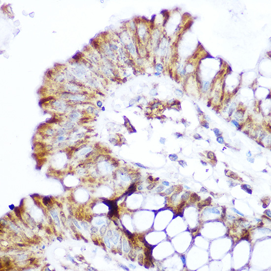 NOD2 Rabbit Polyclonal Antibody