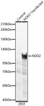 NOD2 Rabbit Polyclonal Antibody