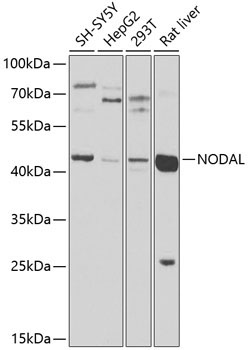 NODAL Rabbit Polyclonal Antibody