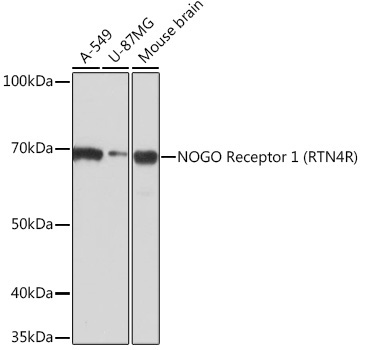 NOGO Receptor 1 (RTN4R) Rabbit Monoclonal Antibody