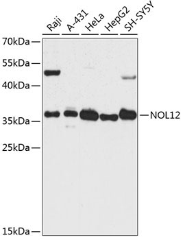 NOL12 Rabbit Polyclonal Antibody