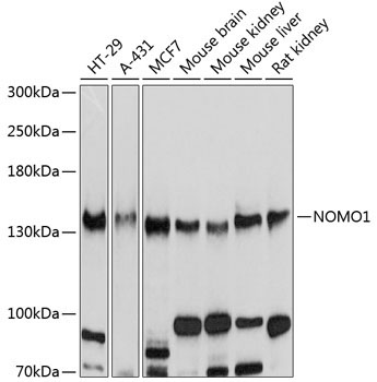 NOMO1 Rabbit Polyclonal Antibody