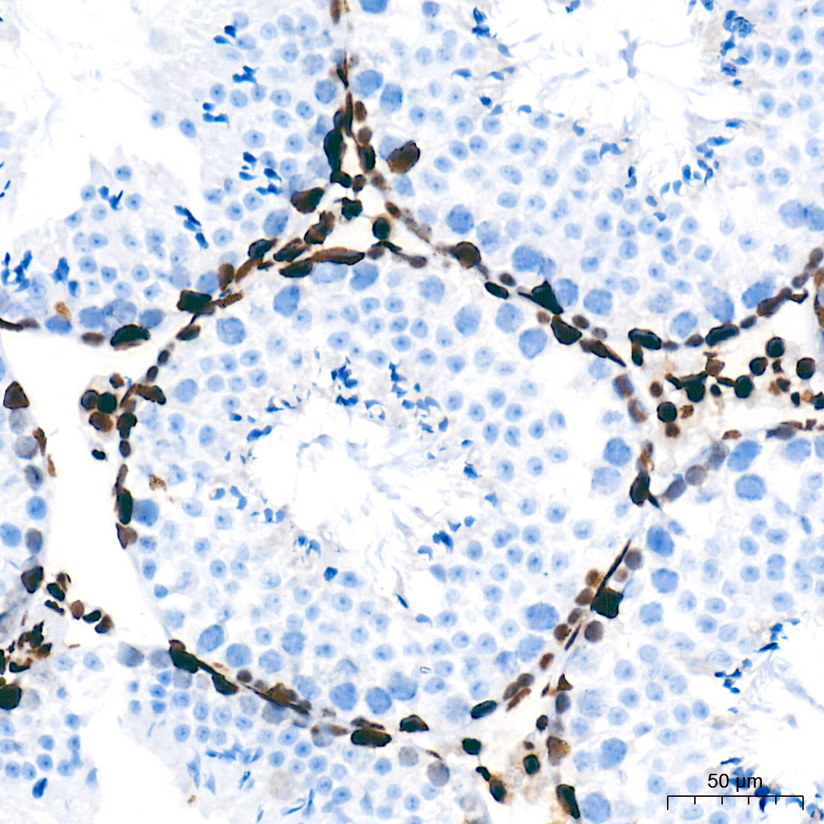 NONO/p54nrb Rabbit Monoclonal Antibody - Image 6