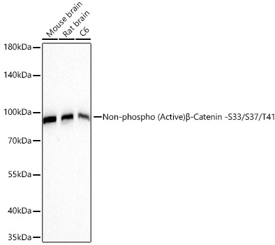 Non-phospho (Active)Beta-Catenin -S33/S37/T41 Rabbit Monoclonal Antibody