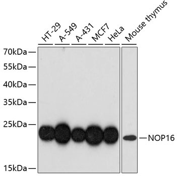 NOP16 Rabbit Polyclonal Antibody
