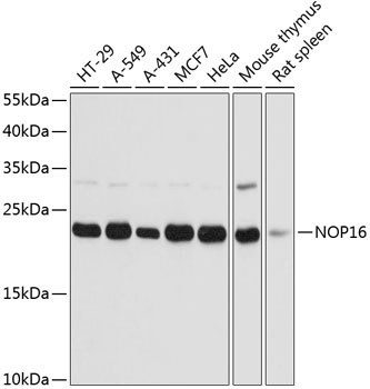 NOP16 Rabbit Polyclonal Antibody
