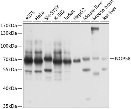 NOP58 Rabbit Polyclonal Antibody