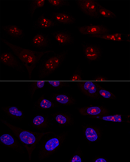 NOP58 Rabbit Polyclonal Antibody - Image 2