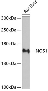 NOS1 Rabbit Polyclonal Antibody