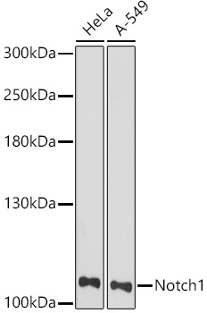 Notch1 Rabbit Polyclonal Antibody