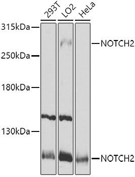 NOTCH2 Rabbit Polyclonal Antibody