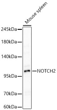 NOTCH2 Rabbit Polyclonal Antibody