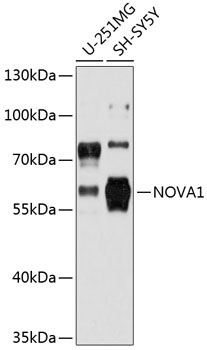 NOVA1 Rabbit Polyclonal Antibody