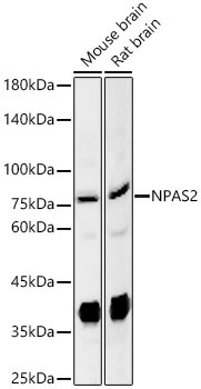 NPAS2 Rabbit Polyclonal Antibody