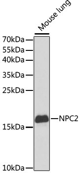 NPC2 Rabbit Polyclonal Antibody