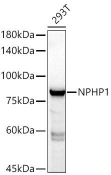 NPHP1 Rabbit Monoclonal Antibody - Image 2