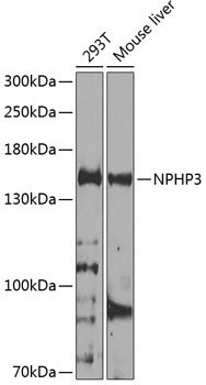 NPHP3 Rabbit Polyclonal Antibody