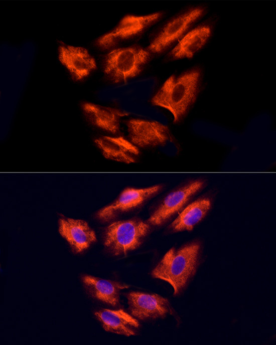 NPHP4 Rabbit Polyclonal Antibody - Image 2