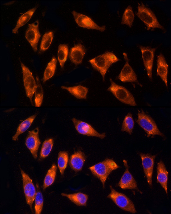 NPHP4 Rabbit Polyclonal Antibody - Image 3