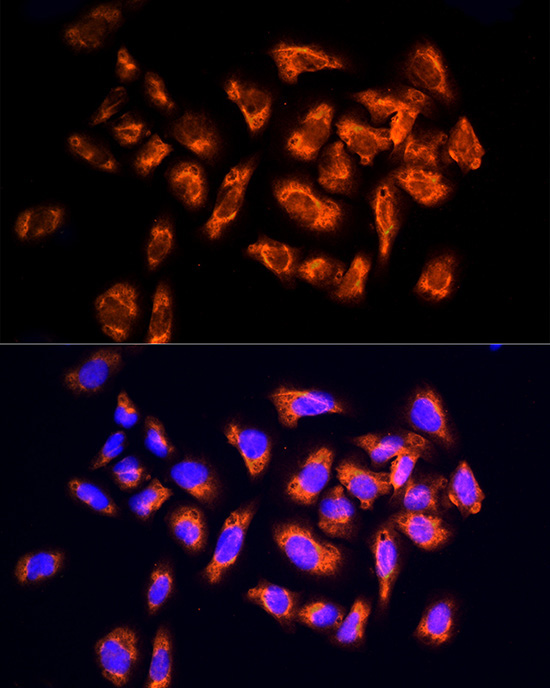 NPHP4 Rabbit Polyclonal Antibody - Image 4