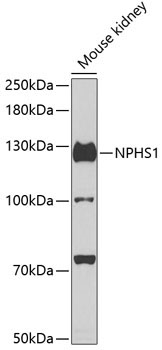 NPHS1 Rabbit Polyclonal Antibody