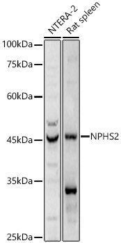 NPHS2 Rabbit Polyclonal Antibody
