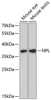 NPL Rabbit Polyclonal Antibody