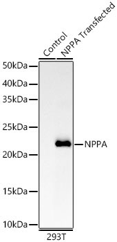 NPPA Rabbit Monoclonal Antibody