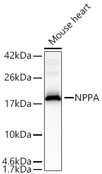 NPPA Rabbit Polyclonal Antibody