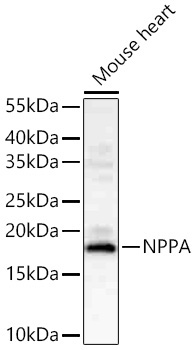 NPPA Rabbit Polyclonal Antibody