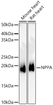 NPPA Rabbit Polyclonal Antibody
