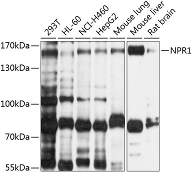 NPR1 Rabbit Polyclonal Antibody