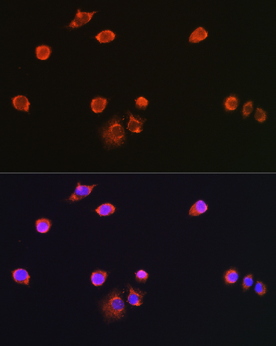 NPR3 Rabbit Polyclonal Antibody - Image 2