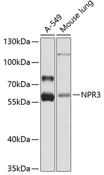 NPR3 Rabbit Polyclonal Antibody