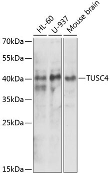 NPRL2 Rabbit Polyclonal Antibody
