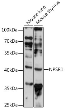 NPSR1 Rabbit Polyclonal Antibody