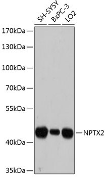 NPTX2 Rabbit Polyclonal Antibody