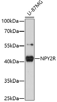 NPY2R Rabbit Polyclonal Antibody